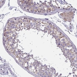 TCEAL8 Antibody, Novus Biologicals 0.1mL; Unlabeled:Antibodies, Polyclonal
